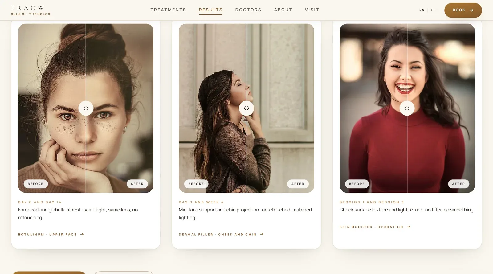 Results page: three before and after cards with a draggable comparison slider and a caption naming the interval and the treatment